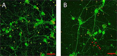 The Feasibility of Encapsulated Embryonic Medullary Reticular Cells to Grow and Differentiate Into Neurons in Functionalized Gelatin-Based Hydrogels